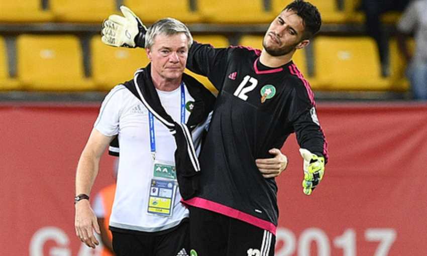 قبل لقاء بيراميدز.. نهضة بركان يعلن إصابة حارسه وغيابه 3 أشهر